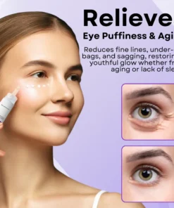 AEXZR™ Eye Puffiness Remover Cream