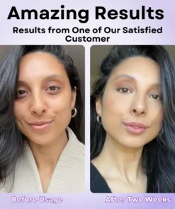 AEXZR™ Eye Puffiness Remover Cream