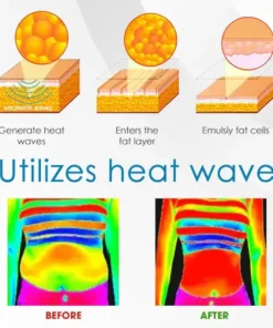 AEXZR™ Ultra-Sonic Body Shaper-Armband