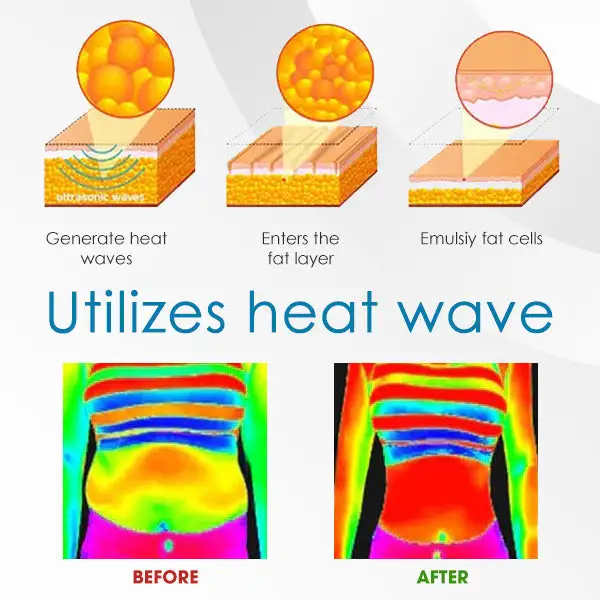 AEXZR™ Ultra-Sonic Body Shaper-Armband