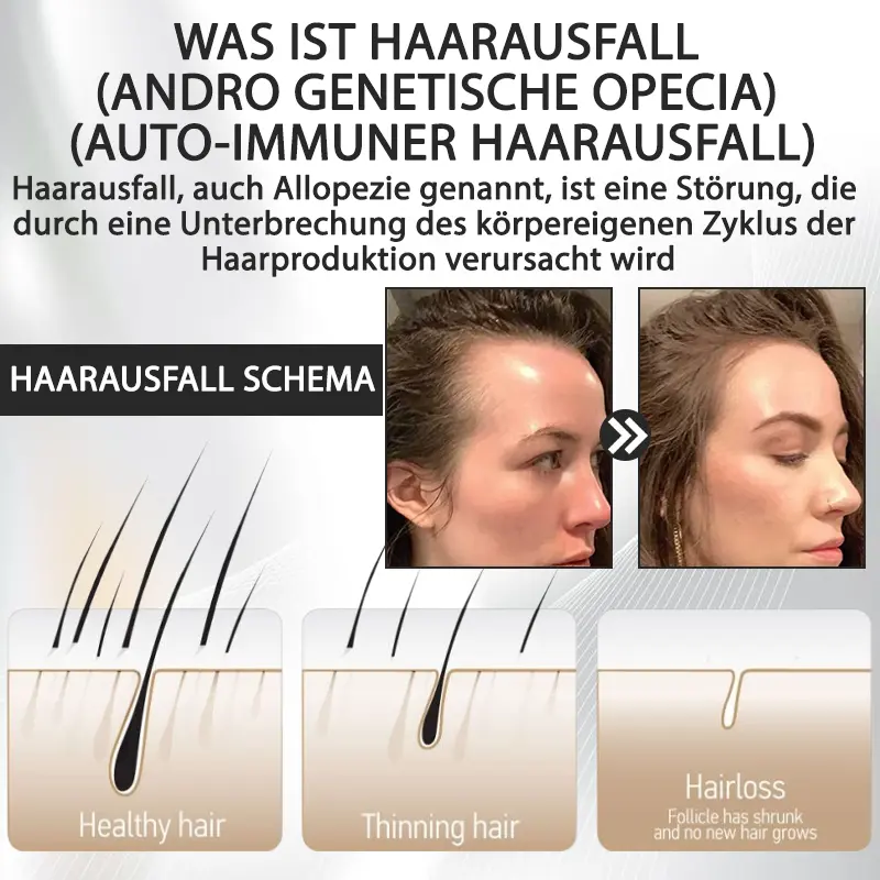 ATTDX™ Alopecia Wiederherstellungs Haar Booster Roll-On