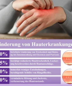 ATTDX™ Violette Beruhigende Hauttherapie Salbe