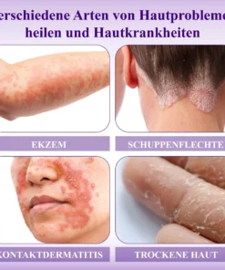 ATTDX™ Violette Beruhigende Hauttherapie Salbe