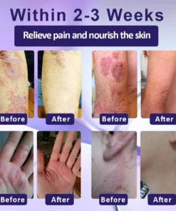 ATTDX™ Violette Beruhigende Hauttherapie Salbe