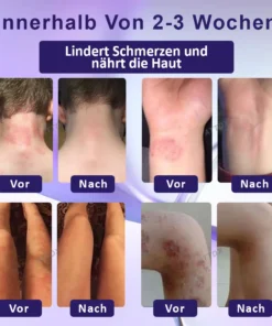 ATTDX™ Violette Beruhigende Hauttherapie Salbe