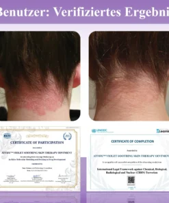 ATTDX™ Violette Beruhigende Hauttherapie Salbe