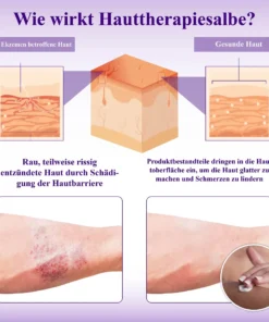 ATTDX™ Violette Beruhigende Hauttherapie Salbe