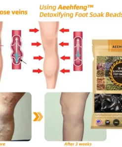 Aeehfeng™ 30-Herb Slimming & Detox Foot