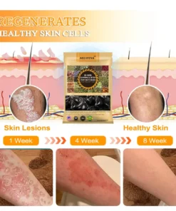 Aeehfeng™ 30-Herb Slimming & Detox Foot