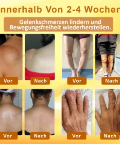 ApisRelief™ GiftFlex Gelenkbehandlungsbalsam