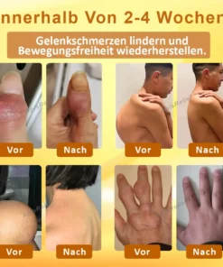ApisRelief™ GiftFlex Gelenkbehandlungsbalsam