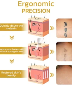 Aprolo™ Spotifly Professioneller elektrischer Beauty-Stift