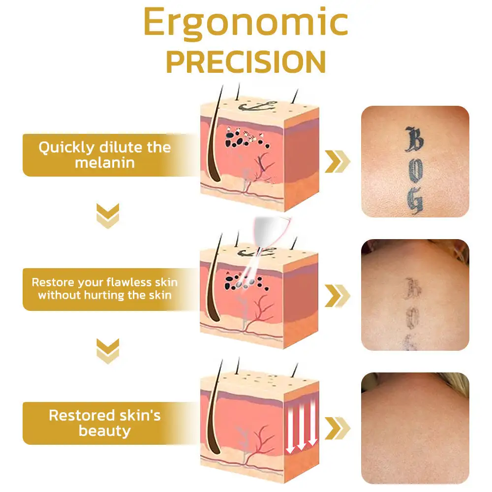 Aprolo™ Spotifly Professioneller elektrischer Beauty-Stift