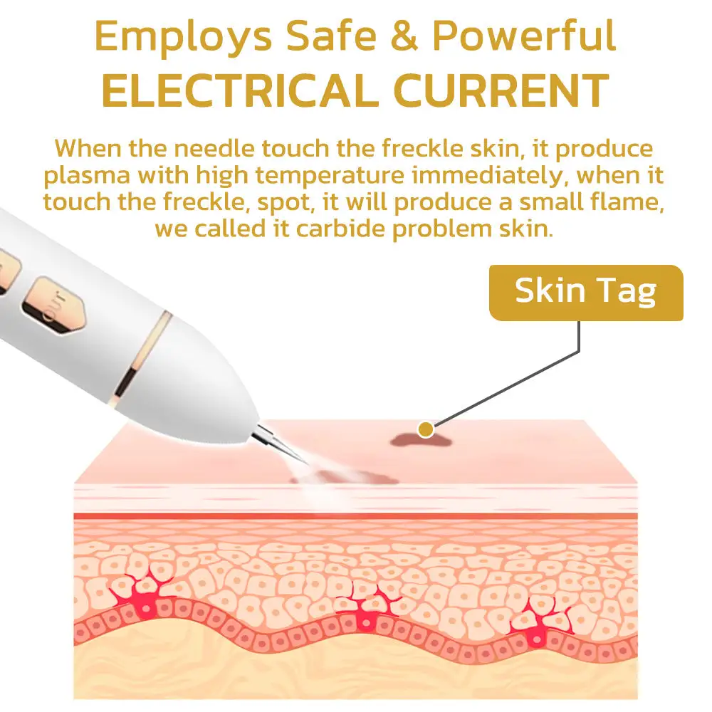 Aprolo™ Spotifly Professioneller elektrischer Beauty-Stift