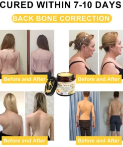 ArthroEase™ Bee Venom Joint and Bone Arthritis Therapy Cream