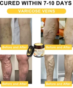 ArthroEase™ Bee Venom Joint and Bone Arthritis Therapy Cream