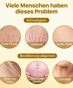 Biancat™ Dehnungsstreifen-Entfernungsöl