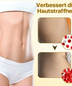 Biancat™ Dehnungsstreifen-Entfernungsöl