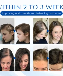 Biancat™ HairRegain Alopecia Recovery Cream