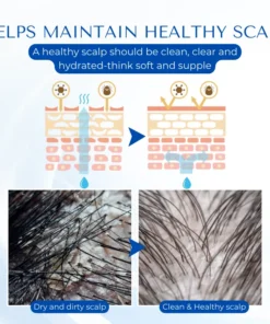 Biancat™ HairRegain Alopecia Recovery Cream