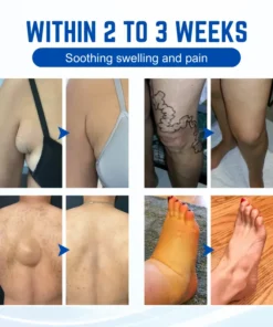 Biancat™ LumpGuard Lymphatic Relief Roll-On