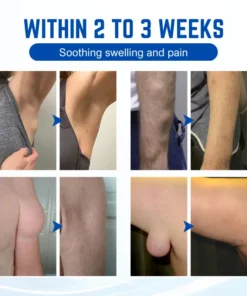 Biancat™ LumpGuard Lymphatic Relief Roll-On