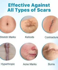 Biancat™ Silikon-Anti-Narben-Creme