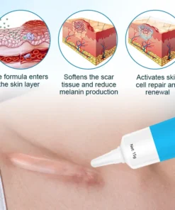 Biancat™ Silikon-Anti-Narben-Creme