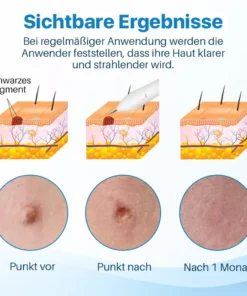 Biancat™ Spotless Pro Elektrischer Schönheitsstift