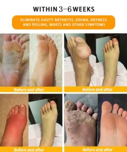 Bostore™30-Kräuter-Fußbadperlen zum Abnehmen und Entgiften