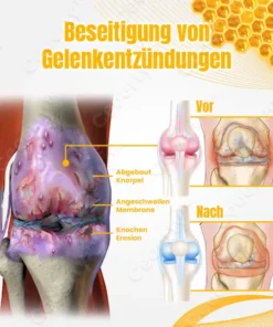 Ceoerty™ BuzzCure Bienengift Gelenk- und Knochentherapie Creme