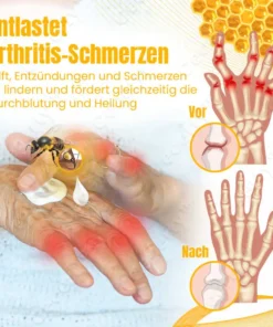 Ceoerty™ BuzzCure Bienengift Gelenk- und Knochentherapie Creme