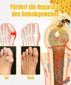 Ceoerty™ BuzzCure Bienengift Gelenk- und Knochentherapie Creme