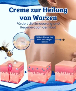 Ceoerty™ CurSkin Bienengift Schuppenflechte & Warzenheilungscreme