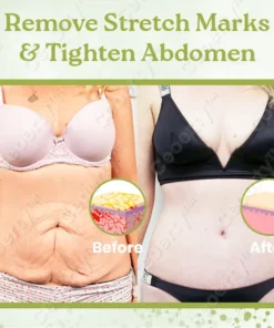 Ceoerty™ InfiLift Kollagen-Straffungscreme