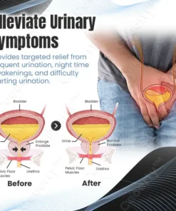 Ceoerty™ Prostaphere Prostate Care Band