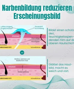 Ceoerty™ RegeniSkin Narbenentfernungsspray