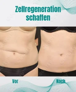 Ceoerty™ RegeniSkin Narbenentfernungsspray