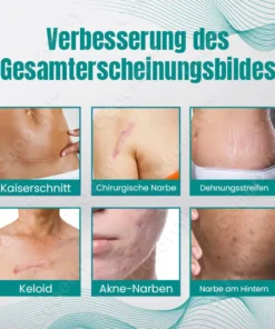 Ceoerty™ RegeniSkin Narbenentfernungsspray