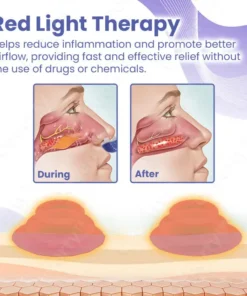 Ceoerty™ RespiEase Nasal Light Therapy Device