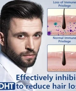 Ceoerty™ RevitaRoot Hair Regrowth Cream