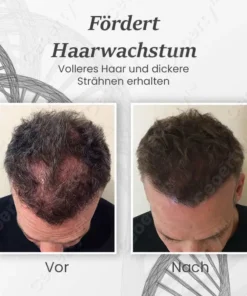 Ceoerty™ SheddStop Pro-Stärke Haarspray