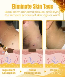 Ceoerty™ SkinXPlus Bienengiftcreme