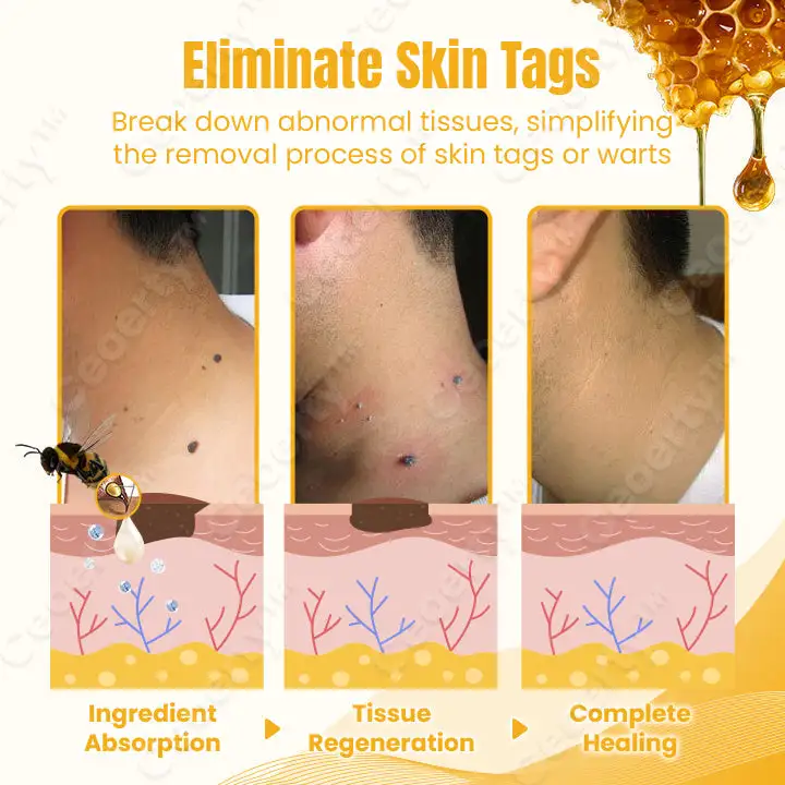 Ceoerty™ SkinXPlus Bienengiftcreme