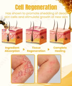 Ceoerty™ SkinXPlus Bienengiftcreme