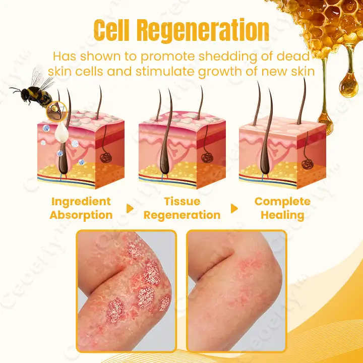 Ceoerty™ SkinXPlus Bienengiftcreme