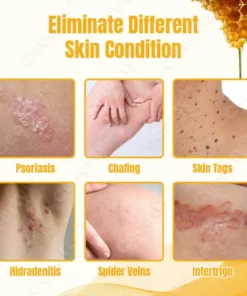 Ceoerty™ SkinXPlus Bienengiftcreme