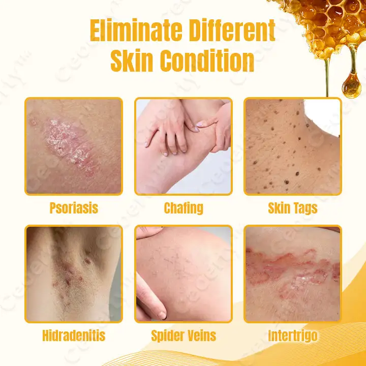 Ceoerty™ SkinXPlus Bienengiftcreme