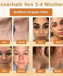 DefyAge™ ApiFormen Botox Alterscreme