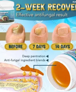 FLYCARE™ 5X QUICK-HEALING Nail Fungus Ointment